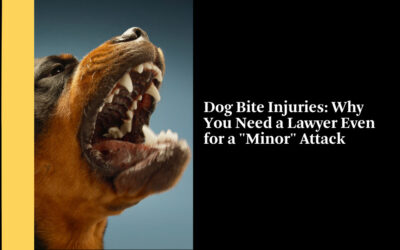 Dog Bite Injuries: Why You Need a Lawyer Even for a “Minor” Attack